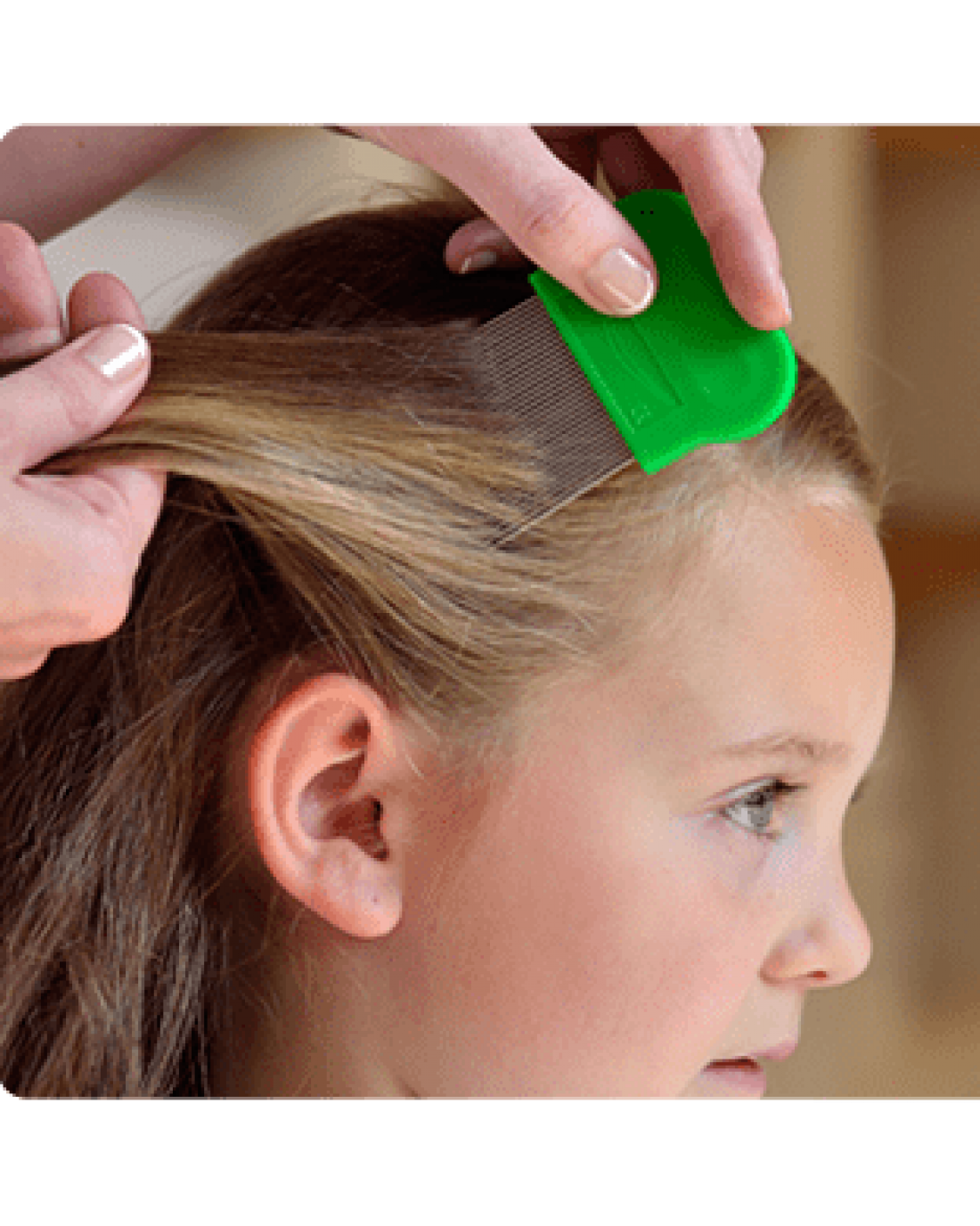 StyleTurk, PARANIT Hair Lice Treatment Spray to Kill Head Lice and Nits