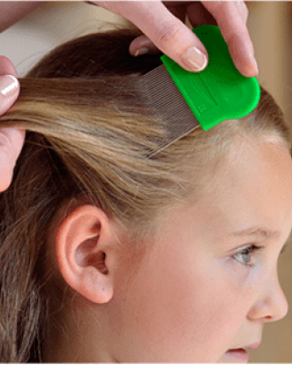 بخاخ بارانيت التخلص من القمل و الصئبان, تخلص من قمل الشعر الرأس خلال 15 دقيقة فقط, الأكثر مبيعاً, 100 مل + مشط خاص هدية