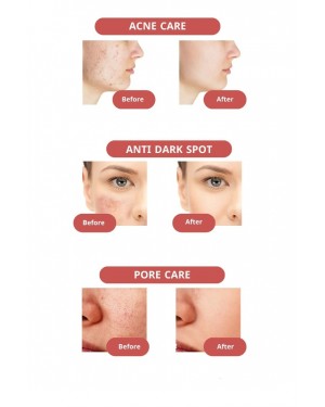 200هيدرو سوليوشن بيبي بور لشد المسام وإنعاشه 7% من حمض الجليكوليك الجينسنغ تونيك حمض الجليكوليك مل  200هيدرو سوليوشن بيبي بور لشد المسام وإنعاشه 7% من حمض الجليكوليك الجينسنغ تونيك حمض الجليكوليك مل