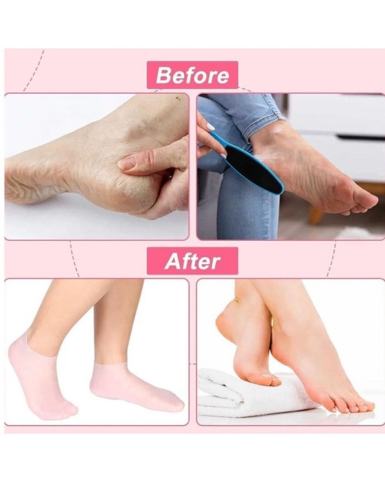 Silicone Foot Therapy Socks – Deep Hydration & Gentle Exfoliation for Dry, Cracked Heels