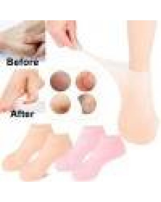 Silicone Foot Therapy Socks – Deep Hydration & Gentle Exfoliation for Dry, Cracked Heels