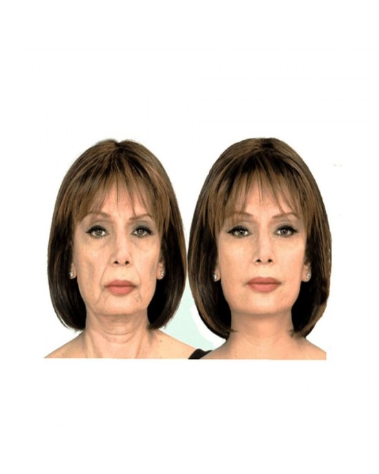 Face Lift Tape – 5M Roll for Instant Skin Tightening, Wrinkle Reduction & Youthful Contours