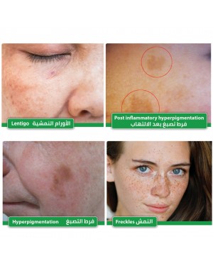Melan IQ Hyperpigmentation Cream, Dark Spot Cream, Skin Spot Cream, Skin Whitening Cream, Pharmaceutical Cream, Revolutionary Formula of Plant Extract, Alpha Arbutin, Glabridin, 30ml Melan IQ Hyperpigmentation Cream, Dark Spot Cream, Skin Spot Cream, Skin Whitening Cream, Pharmaceutical Cream, Revolutionary Formula of Plant Extract, Alpha Arbutin, Glabridin, 30ml
