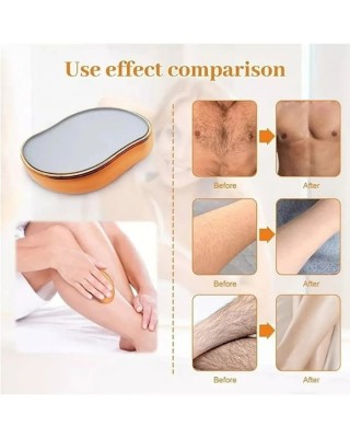 جهاز إزالة الشعر مع منديل الريشة - تكنولوجيا الكريستال